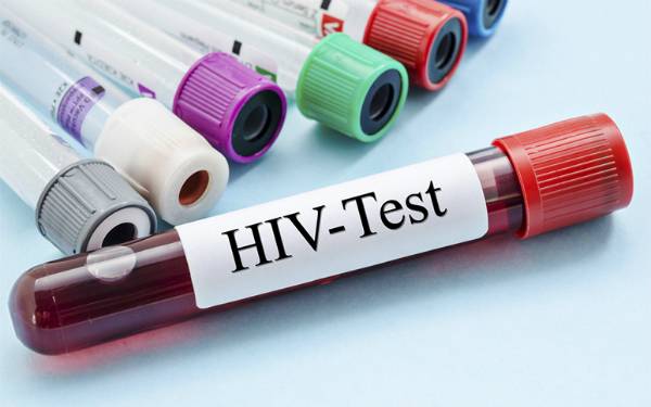 Tầm soát thế nào khi nghi ngờ nhiễm HIV